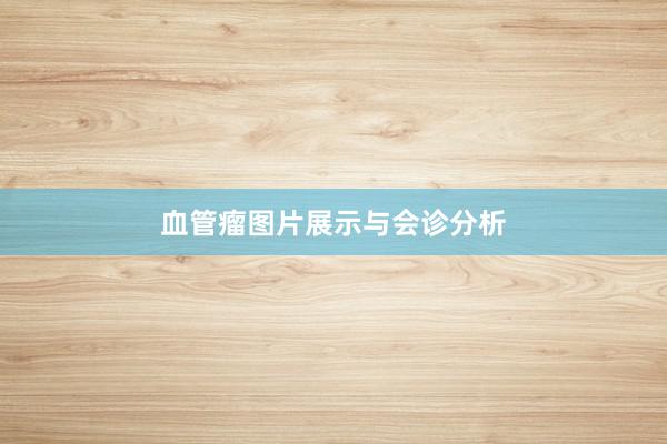 血管瘤图片展示与会诊分析